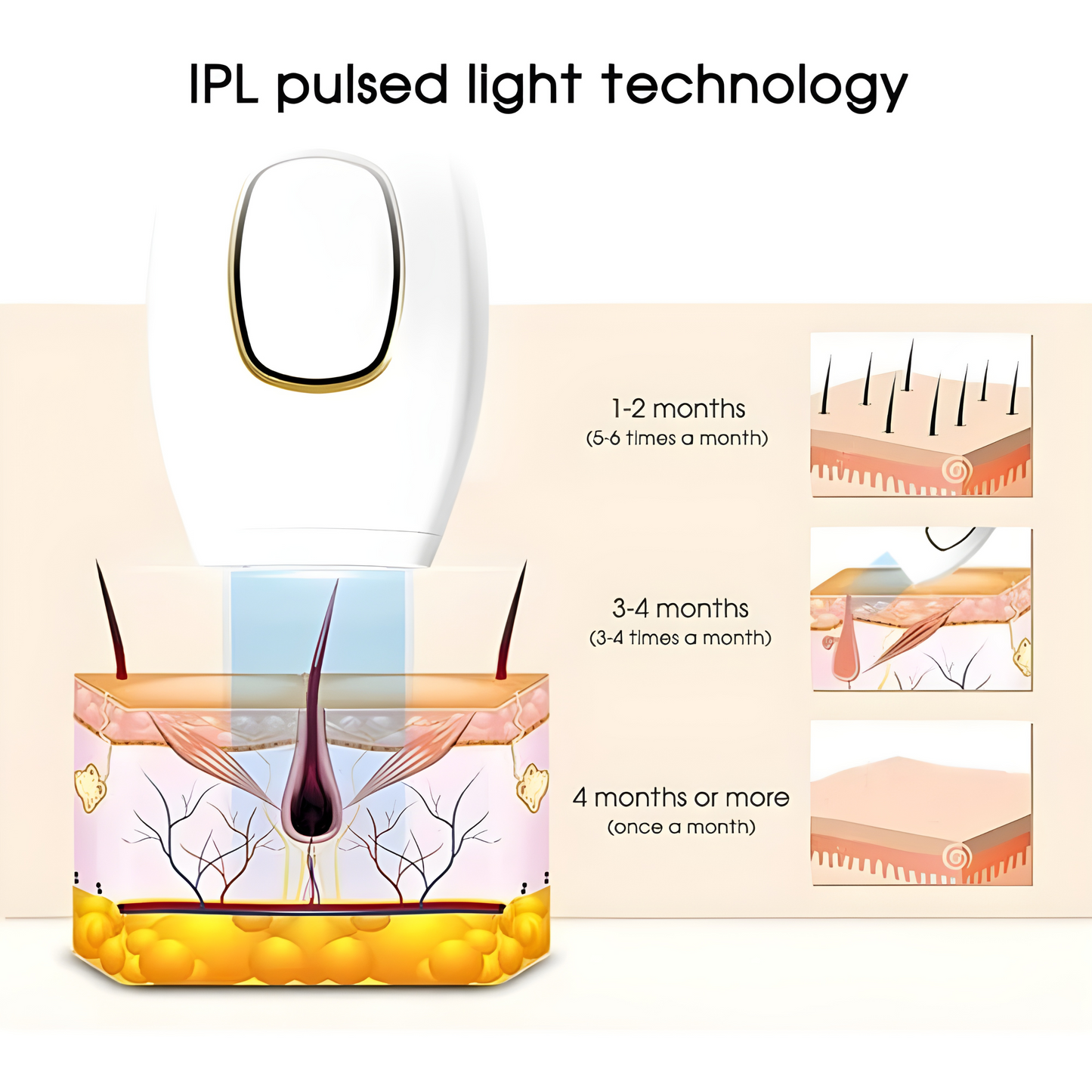 Silk Laser Hair Remover