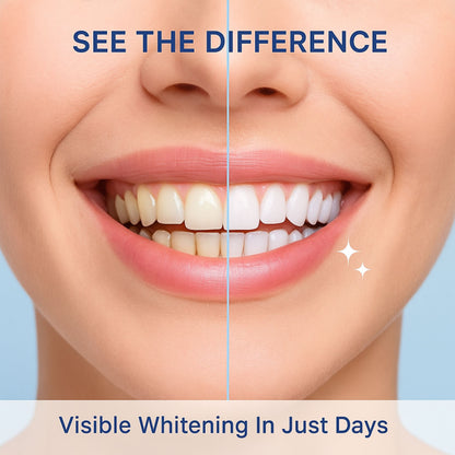 Self Brushing Toothbrush + Built In Whitening