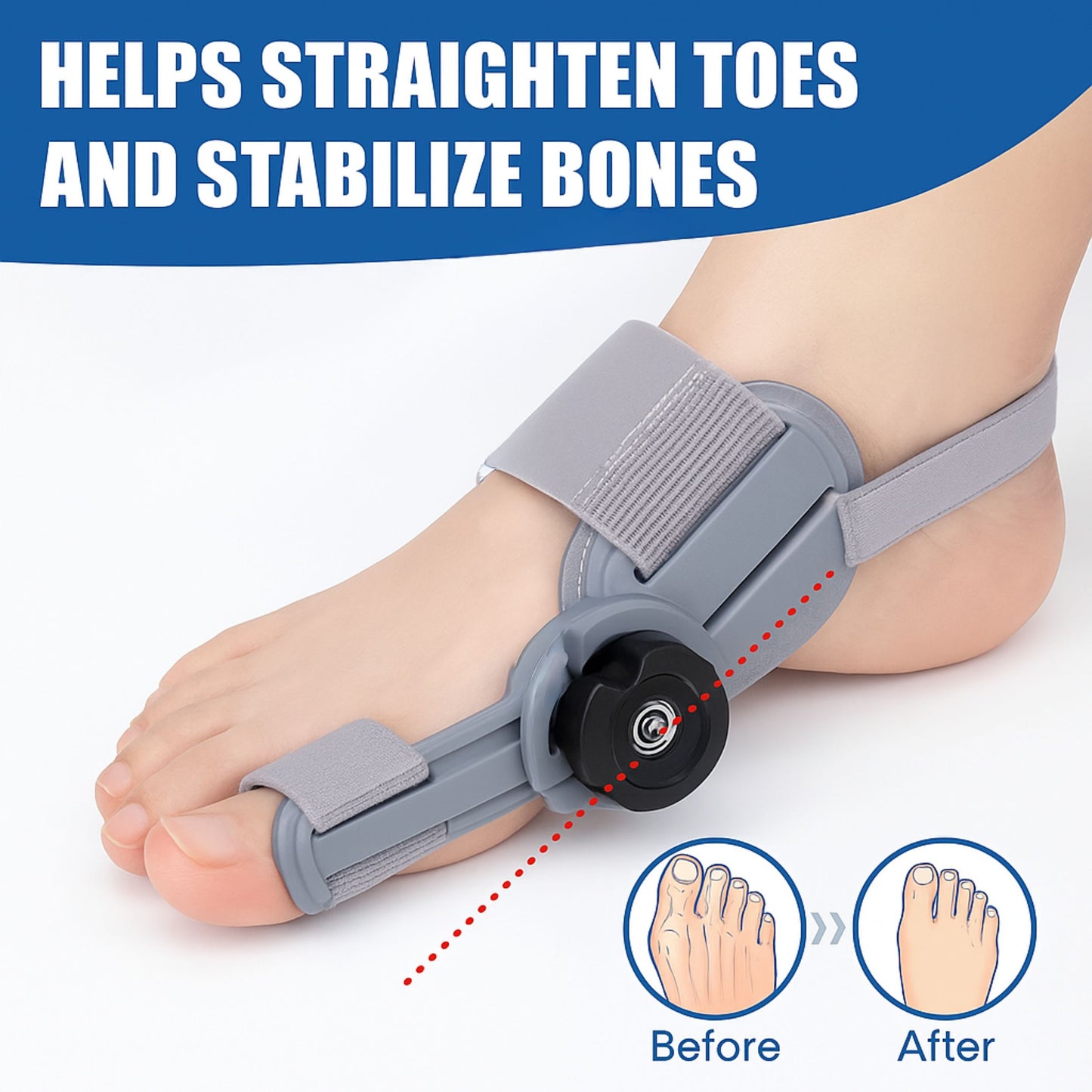 Bunion Corrector
