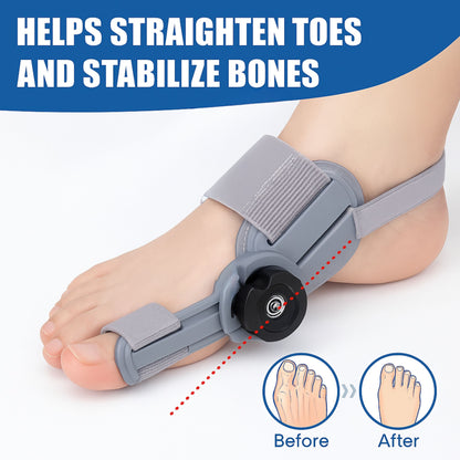 Bunion Corrector